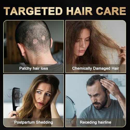 5% Minoxidil Hair Growth Spray with Biotin & Rosemary - 3.38 Fl Oz