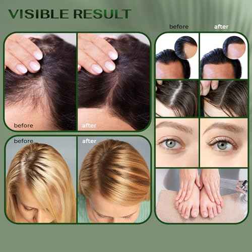 Batana & Rosemary Oil for Hair Growth - 100% Pure Organic Blend (4 FL OZ) - with Scalp Massager & Applicator - Dr. Sebi Inspired Formula - For Men & Women