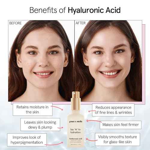 grace & stella Award Winning Hyaluronic Acid Serum (50ml/1.7 fl oz) Hydrating Hyaluronic Acid Serum for Face - Acido Hialuronico for Women - Remove Fine Lines, Wrinkles, Anti Aging - Vegan Skincare