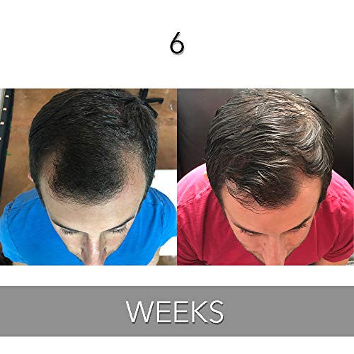 Biotin Vitamin Hair Growth Conditioner-(High Potency) Biotin Conditioner For Fastest Hair Growth, Anti Hair Loss Conditioner, Vitamins E, A, And C, B. THE PRODUCT