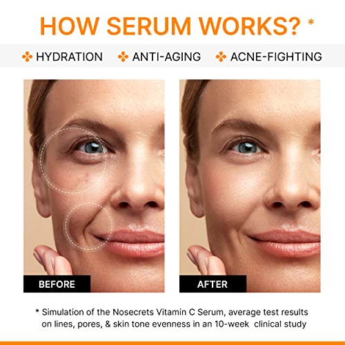 Advanced Vitamin C Serum for Face with Hyaluronic Acid & Centella Asiatica and Gotu Kola Extract | Potent Anti-Aging Serum for Dark Spots, Fine Lines, Wrinkles | Intensely Hydrate Serum