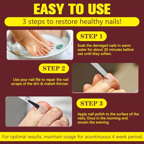 Toenail Fungus Treatment Extra Strength - 25% Undecylenic Acid