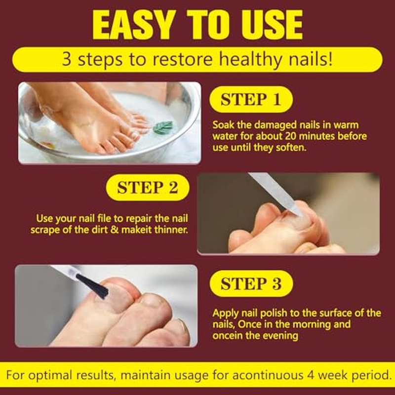 Extra Strength Toenail Fungus Treatment with 25% Undecylenic Acid