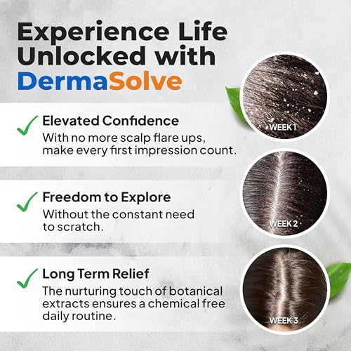 Dermasolve Psoriasis & Dandruff Scalp Oil for Itch Relief