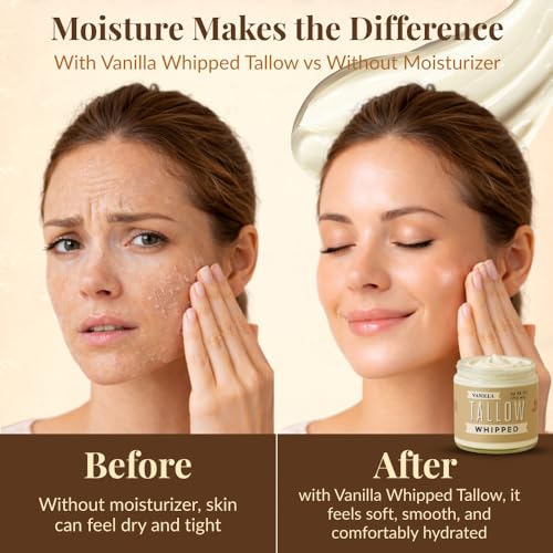 Whipped Tallow 9oz - All Natural Face Cream + Whole Body Moisturizer for Dry Skin - Made With Scented Oil Blend - No Preservatives, Parabens or Seed Oils - USA Made (Vanilla)