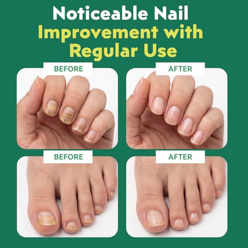 Nail Care Pen 3-Pack - Professional Nourishing Serum for Discolored Nails
