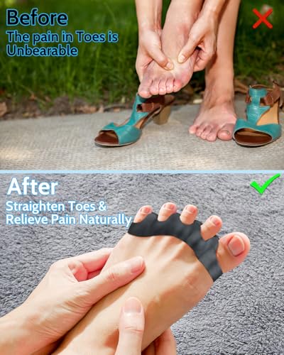 Silicone Toe Separators for Bunion Relief & Alignment - 4PCS
