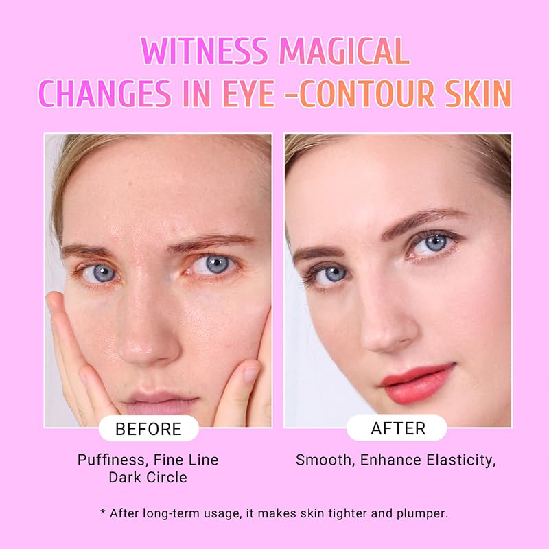 Gold Hyaluronic Acid Eye Patches for Dark Circles & Puffiness, 30 Pairs