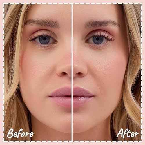 Lip Treat Balm - Hydrating & Nourishing Lip Balm with Avocado, Olive, and Coconut Oils - Smooth, Softening Lip Moisturizer & Protection for Very Dry Lips - Marshmallow Scented, 0.7oz