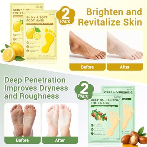 BESNEL 8-Pack Moisturizing & Exfoliating Foot Mask Socks - 4 Styles