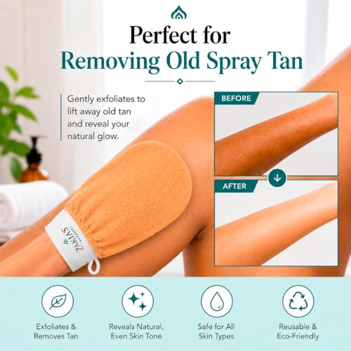 Kessa Exfoliating Glove - Microdermabrasion Mitt for Dead Skin Removal