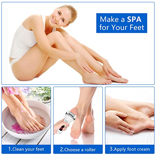 Elmchee Electric Foot Callus Remover Kit - Rechargeable Foot File with 3 Heads