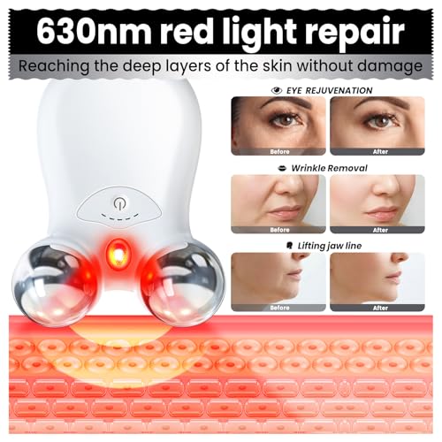 Microcurrent Facial Device with Red Light Therapy - V-Shape Lift