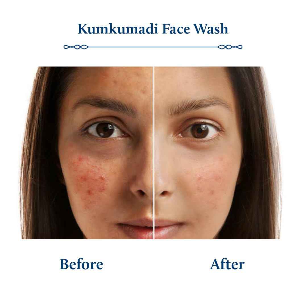 Blue Nectar Kumkumadi Brightening Face Wash with Saffron for Women & Men | Sulphate free Anti Pimple Face Cleanser (10 Herbs, 3.38 Fl Oz)