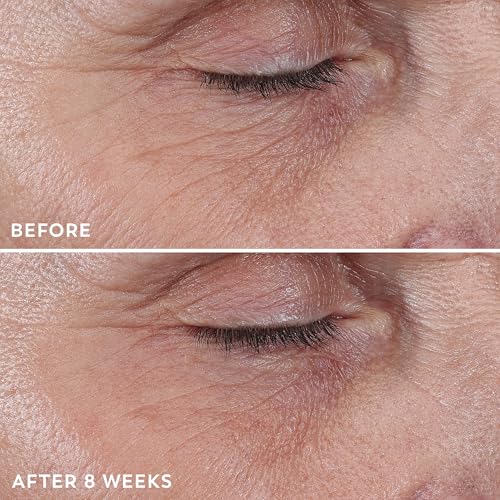 Olay Regenerist Under Eye Cream Roller, Eye Wrinkle Cream, Crows Feet & Bags Treatment, Anti-Wrinkle, Anti-Aging Serum, Fragrance-Free, Hexa-Repair Peptide & Bakuchiol, 0.7oz