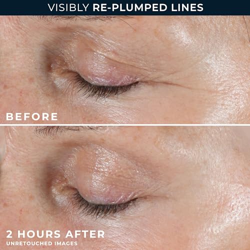 RoC Retinol Wrinkle Correxion Patches, 6-Count with Hyaluronic Acid