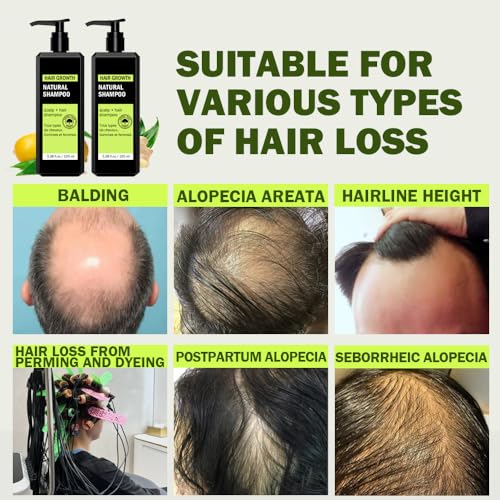 Natural Hair Growth Shampoo for Thinning Hair - 2 Pack