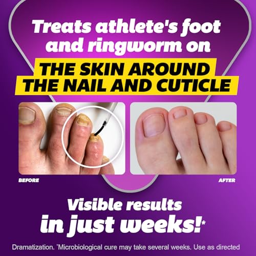 Silka Max Strength Antifungal Liquid for Toenails