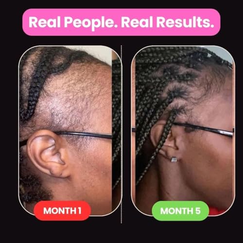 Hair Growth Oil with African Chebe Powder - 2 Oz