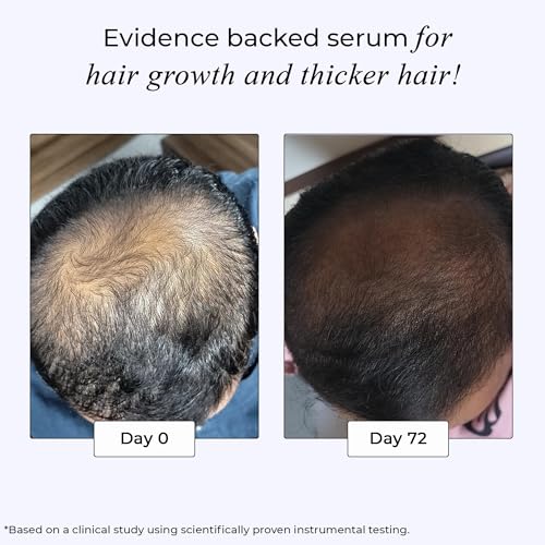 Dr.Su Revive Hair Growth Serum - 4% Anagain & 3% Redensyl