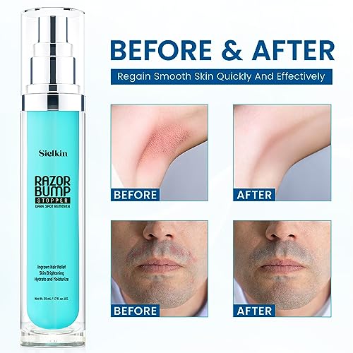 Shave Razor Bump Ingrown Hair Aftershave: Treatment Lotion for Sensitive Zone - Men & Women Skin Care Upgraded Formula 1.7 Fl Oz