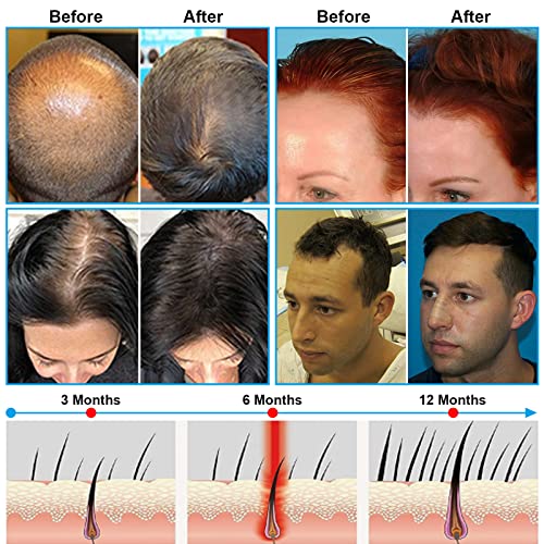 Red Light Therapy for Hair Growth red Light hat Cap Helmet for Hair Regrowth Scalp Health