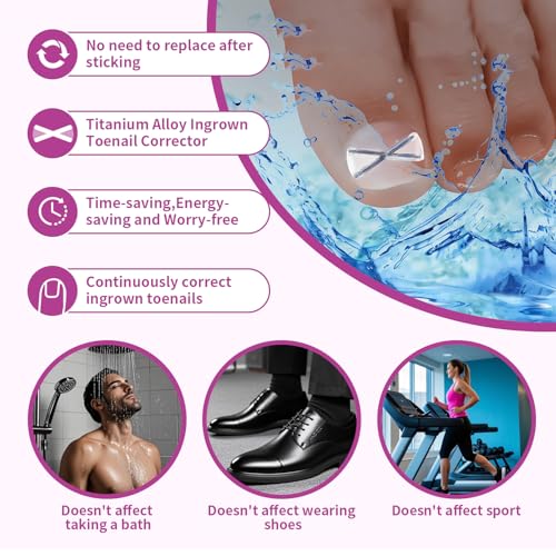 10 Patchs X-Shaped Upgrade Titanium Alloy Ingrown Toenail Corrector,At Home Ingrown Toenail Treatment for Man and Women,Ingrown Toenail Removal Kit,Curved Toenail Straightener (Small Size)