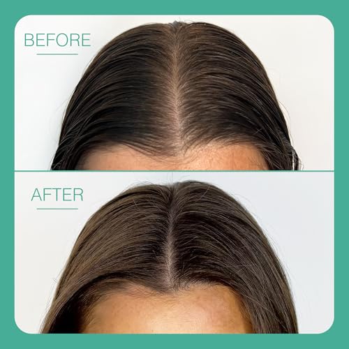 Function of Beauty Deep Cleaning Dry Shampoo for Normal to Oily Hair - Talc-Free Dry Shampoo with No Visible Residue - Lightweight, Volumizing & Fast-Absorbing for Excess Oil, Sweat & Odor