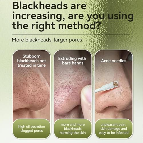 Vemofoper Blackhead Remover Mask 60 pcs,Remove Black Heads Face Black Head Remover Strips,Nose Plants Pore Cleanser Purifying Face Mask for All Skin Types(1.05oz/30g)