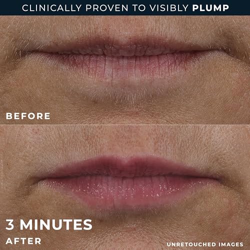 RoC Derm Correxion Lip Volumizer - Peptide Lip Plumper