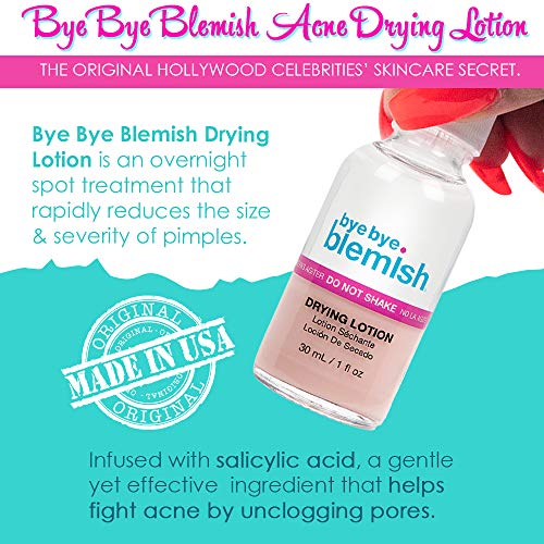 Bye Bye Blemish Acne Drying Lotion, Reduce Pimples Overnight 1oz, 1-Pack