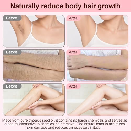 Cyperus Seed Oil - Natural Hair Growth Inhibitor - 2 Bottles