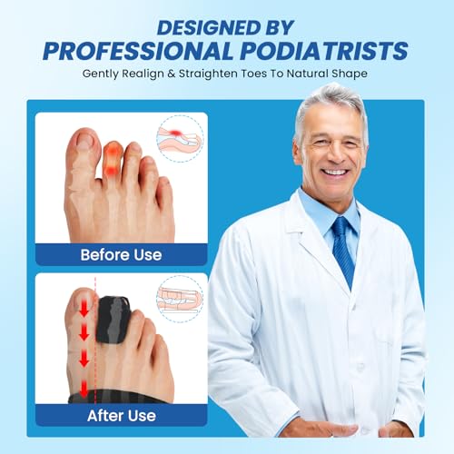 Hammer Toe Straightener Corrector with Aluminum Support