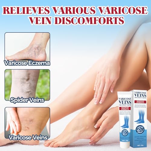 Varicose Veins Treatment for Legs, Varicose Veins Cream for Spider Veins, Relaxing Leg Cream Formula to Improve Circulation, Soothe Tired Legs and Reduce Heaviness