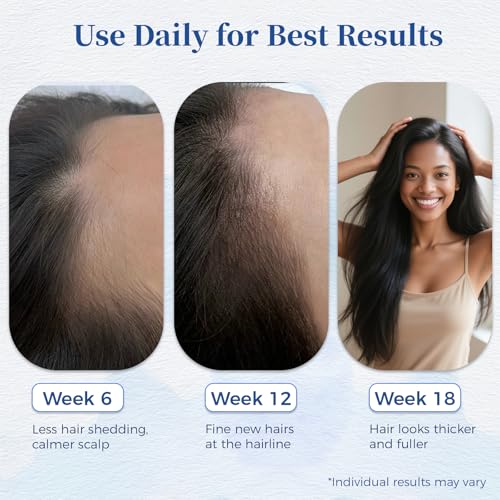 Hair Growth Serum Roll-On with Rosemary & Pea Extract for Thicker Hair
