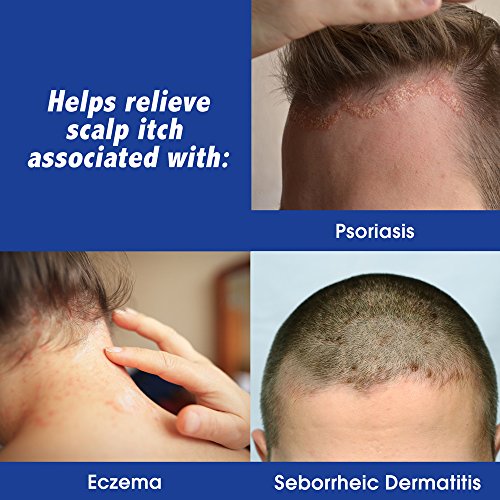 Scalpicin Max Strength Scalp Itch Treatment | 1.5 oz | Pack of 2
