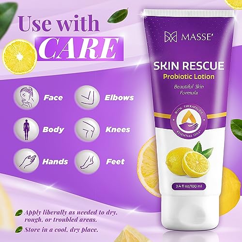 Massey's Skin Rescue Probiotics Lotion - Daily lotion for Men & Women - Refreshing Lemon Scent - Non-Greasy Moisture for Smooth & Sensitive Skin - 3.4 oz