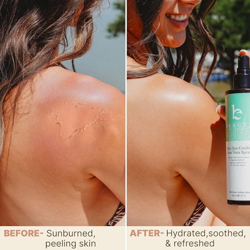 After Sun Cooling Aloe Vera Spray - Fast Absorbing Relief
