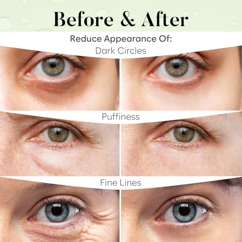 Green Tea Under Eye Patches (30 Pairs), Cooling Eye Mask for Puffy Eyes & Dark Circles, Soothing & Hydrating Gel Pads, Revitalizing Under Eye Care & Skincare Gifts for Women