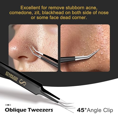 4-in-1 Blackhead Remover Tweezers Set - Stainless Steel