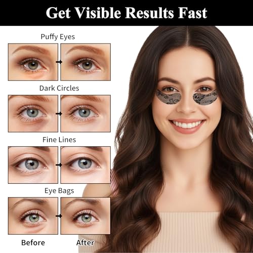 Under Eye Patches,Lace Eye Mask for Puffy Eyes and Dark Circles,Collagen Skin Care Products,Hydrating,Smoothing,Anti-Aging Eye Patch for Under Eye Bags£¨24 Pairs£©