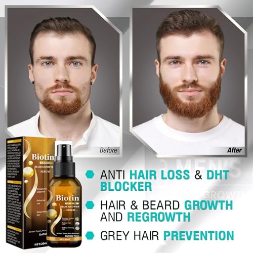 Biotin Hair Growth Serum with Ginseng & Ginger