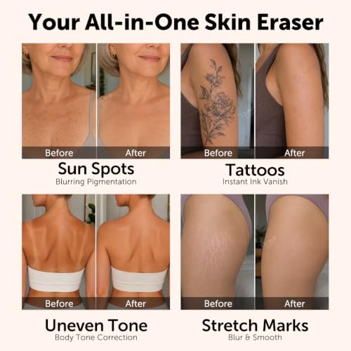 Waterproof Body Concealer with Hyaluronic Acid - Flawless Skin Filter for Legs & Body
