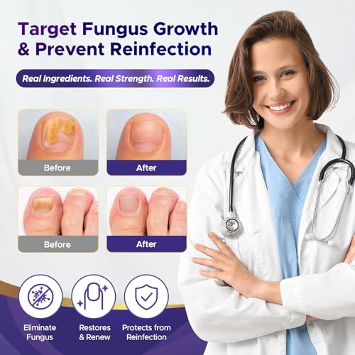 Toenail Fungus Treatment Extra Strength 25% Undecylenic Acid