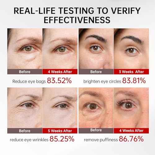 Retinol & Caffeine Eye Serum -360¡Æ Massage Roller for Puffiness,Eyebag Remover,Wrinkle Filler,Under Eye Cream For Dark Circles 0.54fl.oz (Pack of 1)