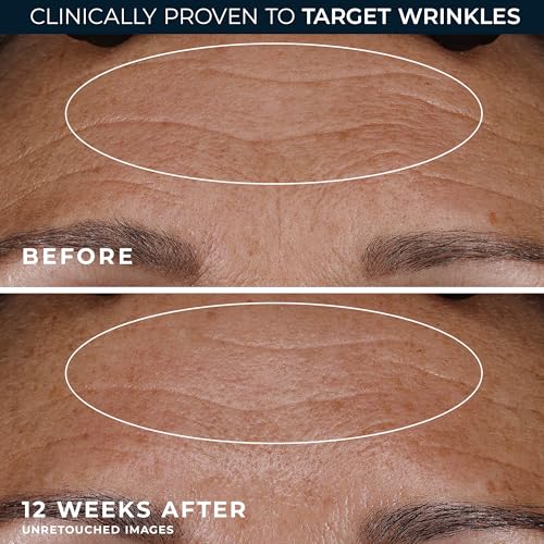 RoC Retinol Correxion Deep Wrinkle Night Cream - Anti-Aging Treatment, 1 oz
