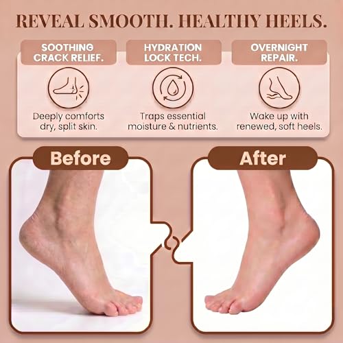 Nesgther Overnight Moisturizing Gel Socks for Dry Cracked Heels - 3 Pack