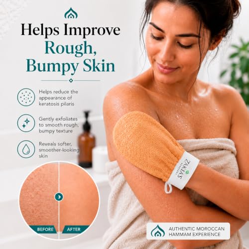 Kessa Exfoliating Glove - Microdermabrasion Mitt for Dead Skin Removal