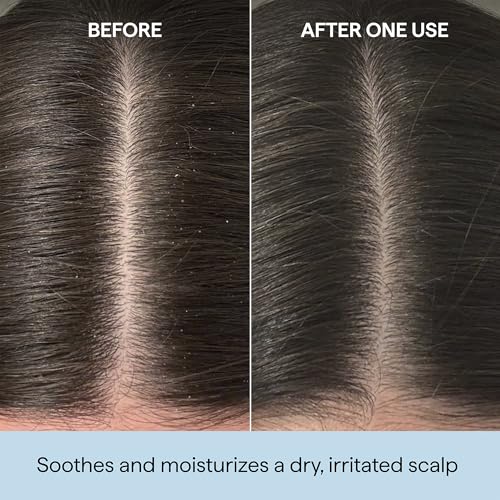 Briogeo Scalp Revival Rosemary Pre-Wash Oil | Dry Scalp Treatment