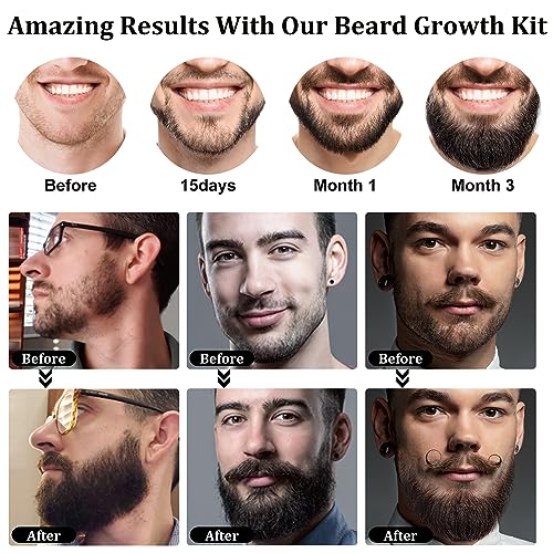 Beard Growth Kit, Upgraded Beard Growth Oil (2Oz) w/3 X Thickening Biotin & Castor Oil for Spot/Patchy Beard, Achieve Fuller, Thicker & Healthier Beards, Birthday Gifts for Men Him Boyfriend Husband